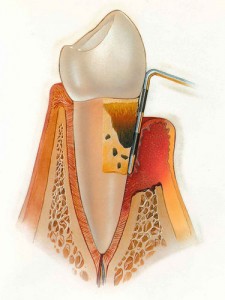 periodoncia
