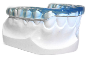 Fèrula de descàrrega